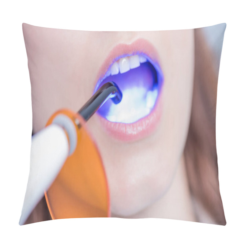 Personality  Patient And Dental Curing Light Pillow Covers