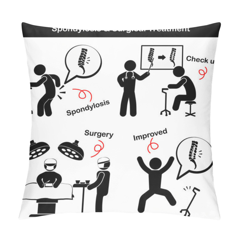 Personality  Spondylosis And Spondylolisthesis And Surgical Treatment Pictogram  ( Old Man Suffer To Low Back Pain ( Lumbar Pain ) , He Was Checked Up And Operated , Spine Was Internal Fixed By Plate And Screw ) Pillow Covers