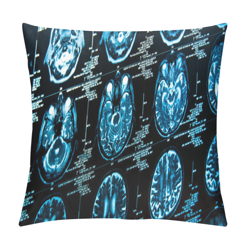 Personality  Closeup Of A Computer Axial Tomography Scan (CAT Scan) Pillow Covers