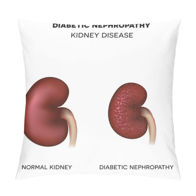 Personality  Diabetic Nephropathy, Kidney Disease Pillow Covers