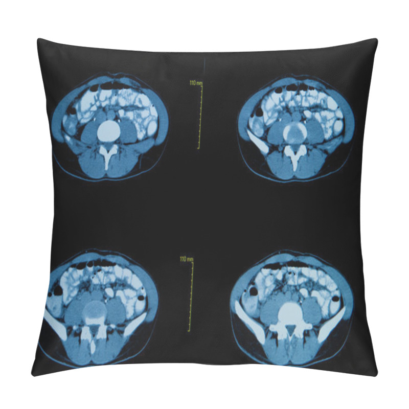 Personality  Computed Tomography Of The Chest. Medical Background Pillow Covers