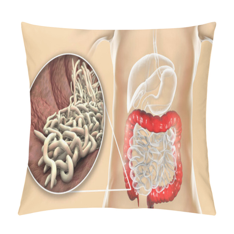 Personality  Parasitic Worms In Human Large Intestine, 3D Illustration. Enterobius Vermicularis And Other Round Worms Pillow Covers