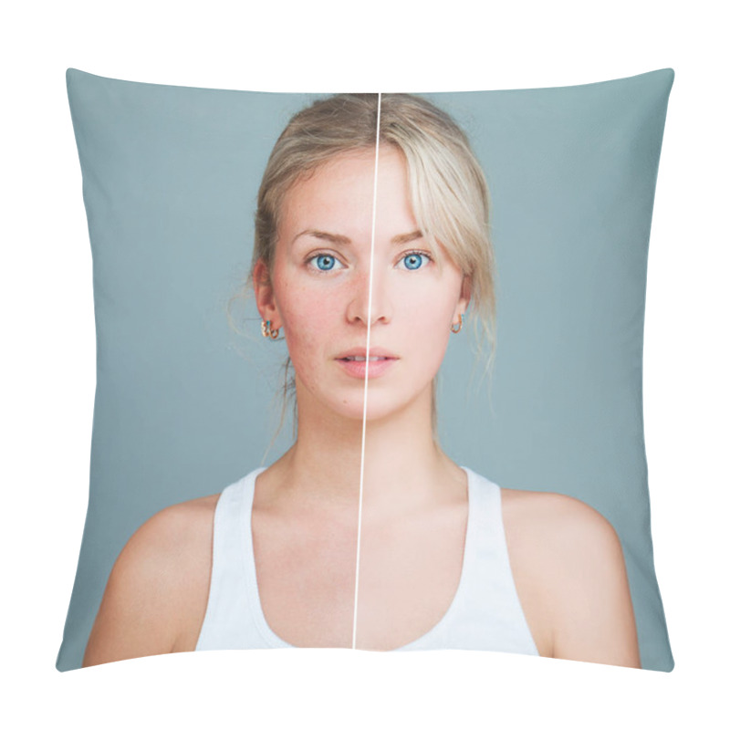 Personality  Young Model Woman With Skin Problem. Female Face Divided Into Tw Pillow Covers