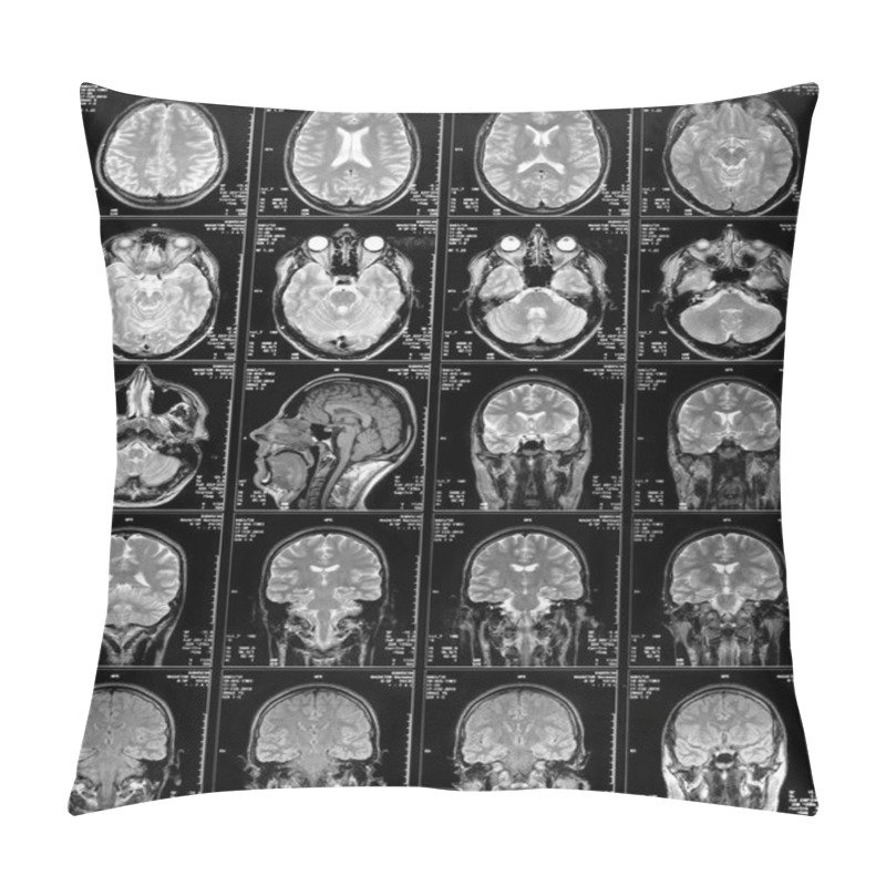 Personality  Magnetic Resonance Imaging Pillow Covers