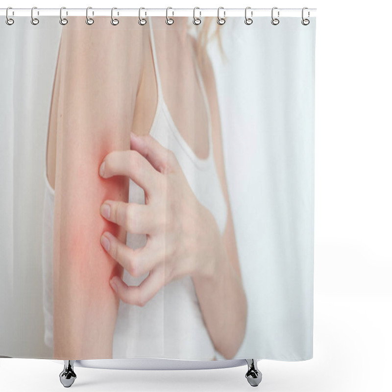 Personality  Woman Scratching Arm, Close-up, Concept Of Itchy Skin  Shower Curtains