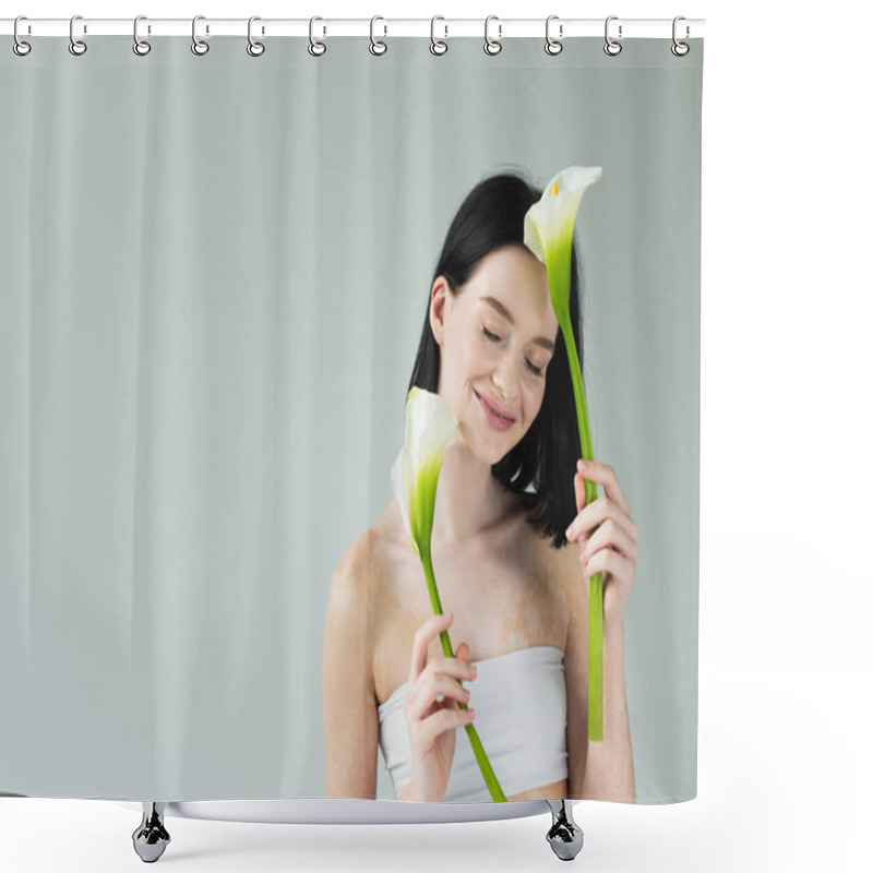 Personality  Smiling Woman With Vitiligo Holding Calla Flowers Isolated On Grey  Shower Curtains