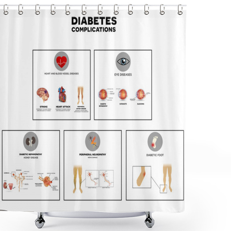 Personality  Diabetes Complications Info Graphic Shower Curtains