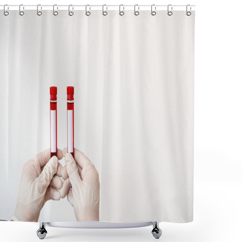 Personality  Laboratory Technician Holding Test Tube Of Extracted Human Blood Sample For Health Risk Diagnostic Tool. Medical Research Analysis Concept Shower Curtains