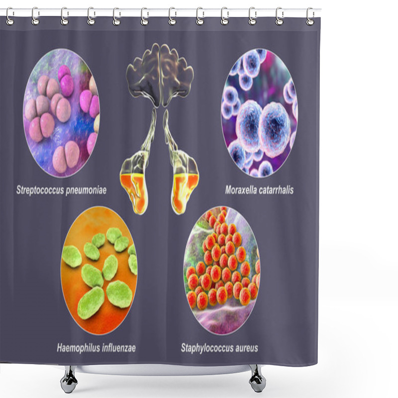 Personality  Anatomy Of Rhinosinusitis And Bacteria That Cause Sinusitis Streptococcus Pneumoniae, Moraxella Catarrhalis, Haemophilus Influenzae, And Staphylococcus Aureus, 3D Labelled Illustration Shower Curtains