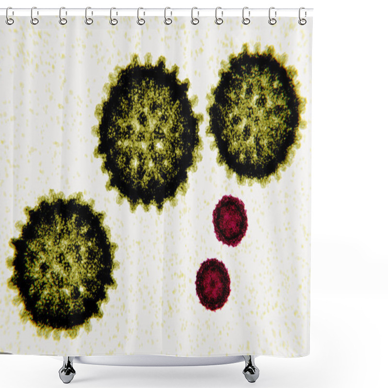 Personality  The Hepatitis C Virus Is A RNA Virus 80-120 Nm In Diameter. Poliovirus Is A Simple RNA Virus 30 Nm In Diameter. Poliovirus Causes Poliomyelitis. Shower Curtains