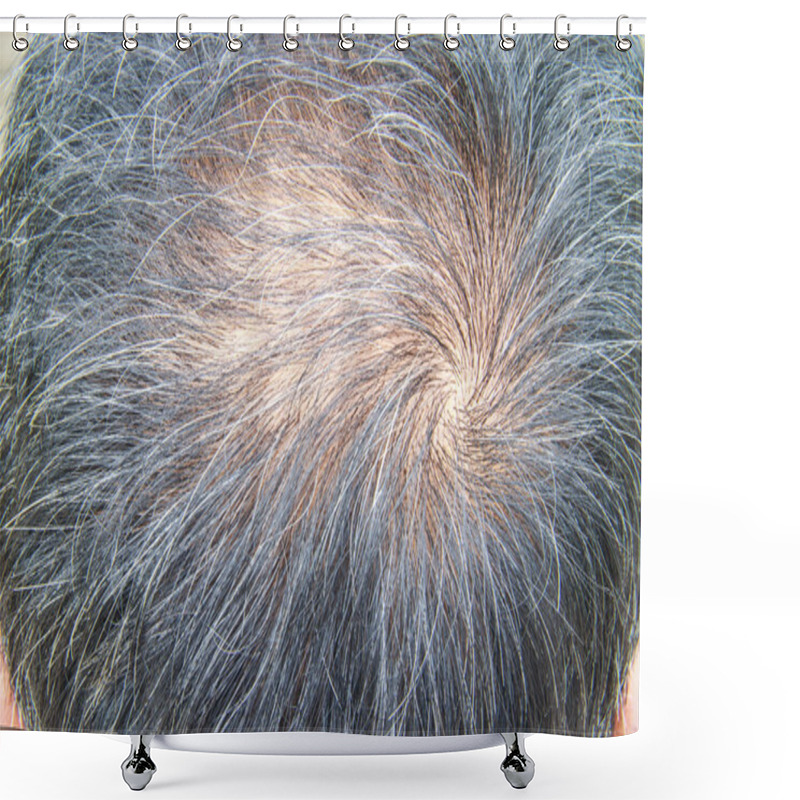 Personality  Hair Loss Shower Curtains