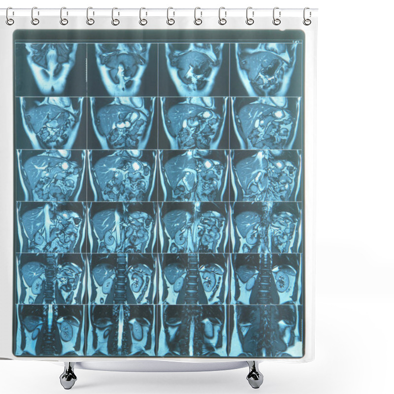 Personality  MRI Scan Image Shower Curtains