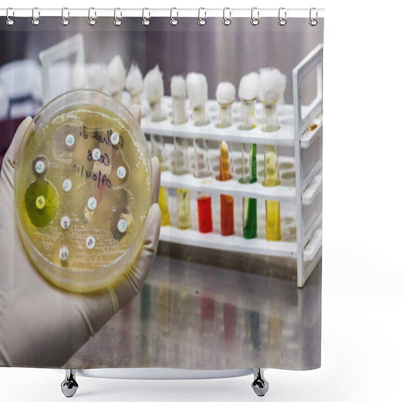 Personality  Side View Of Culture Plate Of Bacterial Growth Showing Antibiotic Sensitivity In Their Colony Pattern Placed Geld In Gloved Hand Shower Curtains