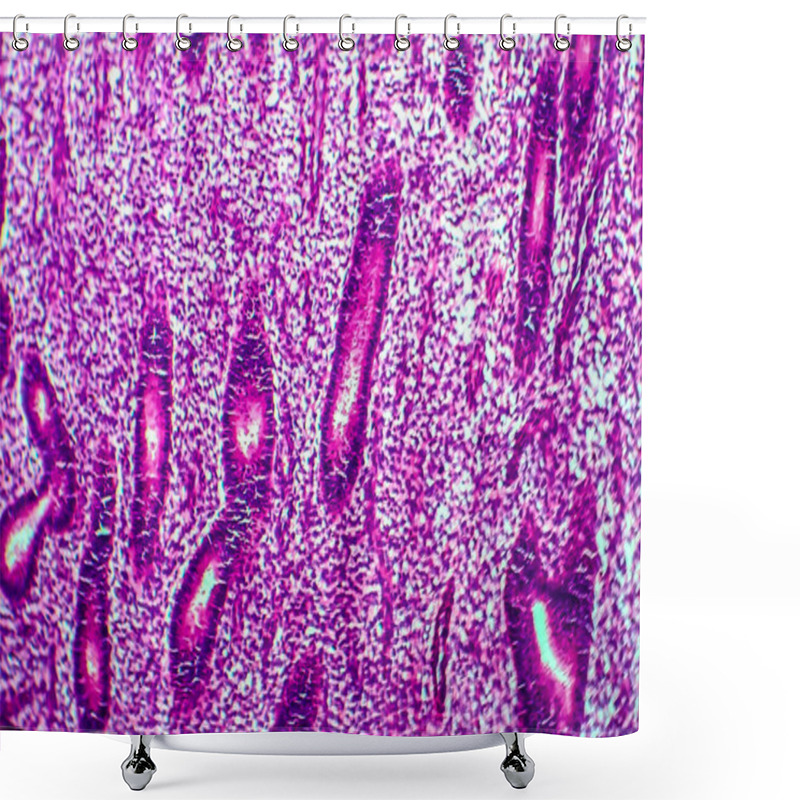 Personality  Endometrial Hyperplasia, Light Micrograph, Photo Under Microscope Shower Curtains