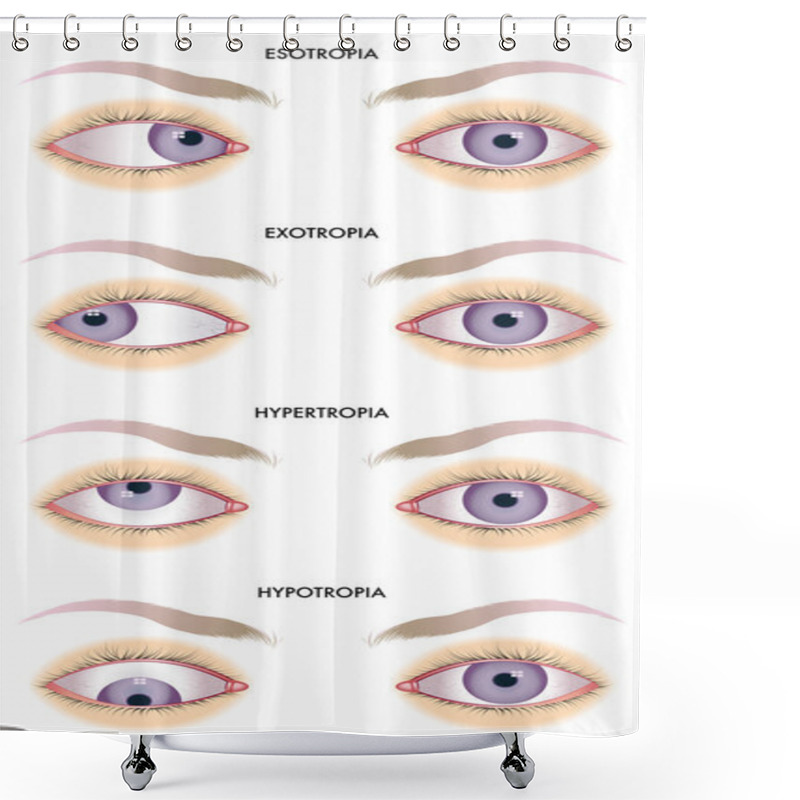 Personality  Strabismus Shower Curtains