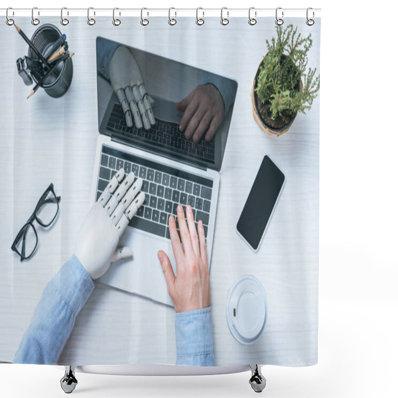 Personality  Cropped Image Of Businessman With Prosthetic Arm Using Laptop At Table With Eyeglasses, Smartphone And Coffee Cup  Shower Curtains