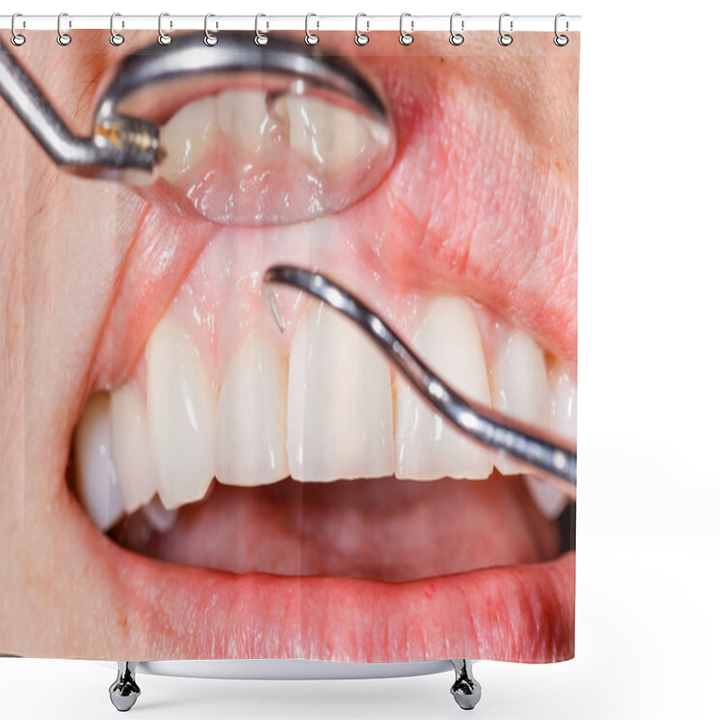 Personality  Dental Examination Shower Curtains