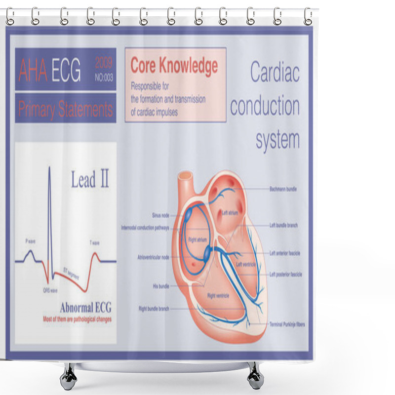 Personality  Abnormal ECG Refers To Changes In Depolarization Waves And Or Repolarization Waves, Most Of Which Are Pathologic And Few Are Physiological. Shower Curtains