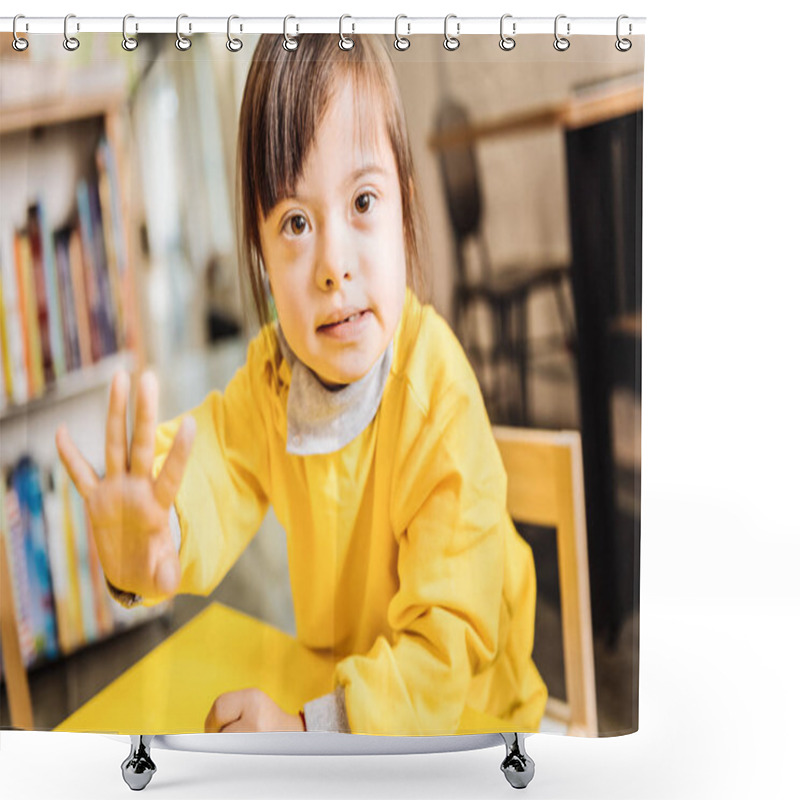 Personality  Dark-eyed Preschool Girl With Genetic Disorder Showing Her Palm Shower Curtains