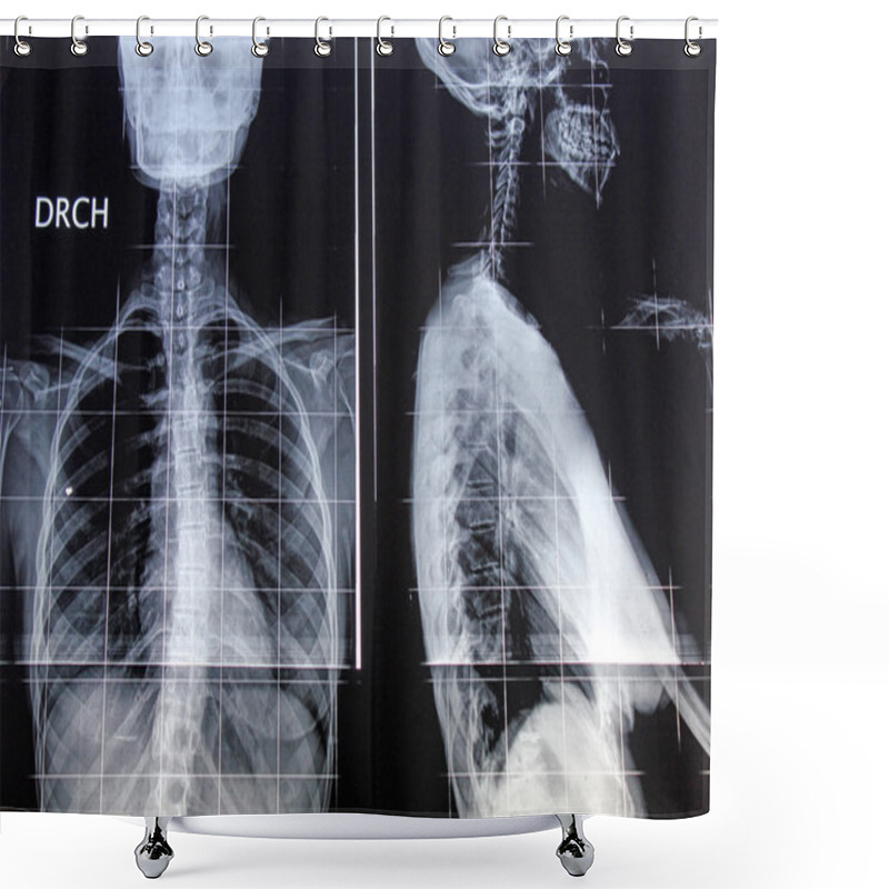 Personality  Radiography Of Back And Profile Shower Curtains