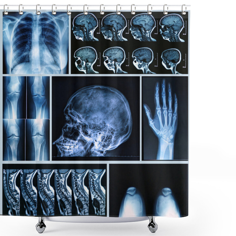 Personality  Radiography Of Human Bones Shower Curtains