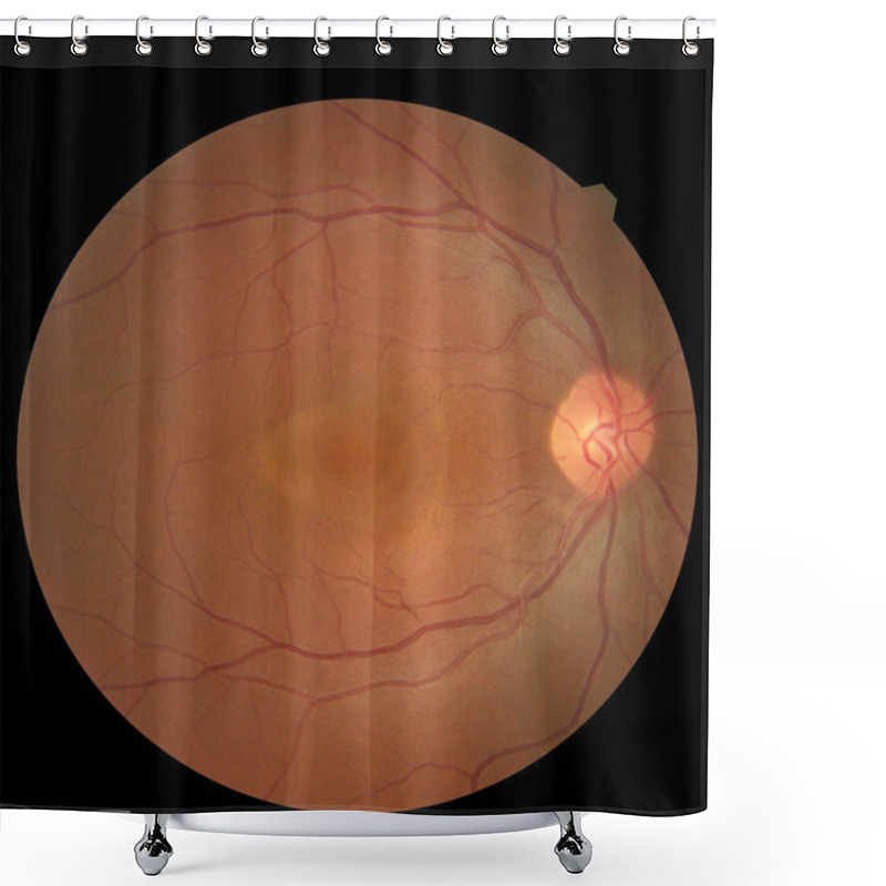 Personality  View Inside Human Eye Showing Retina, Optic Nerve And Macula. Health Concept Shower Curtains