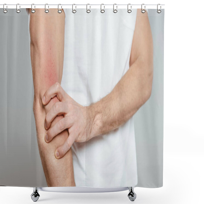 Personality  Cropped View Of Man Touching Hand With Allergy Isolated On Grey Shower Curtains