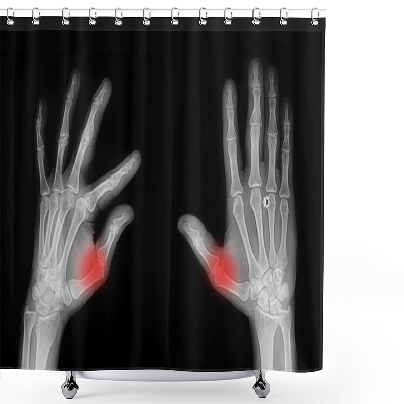 Personality  X-ray Hand And Finger Shower Curtains