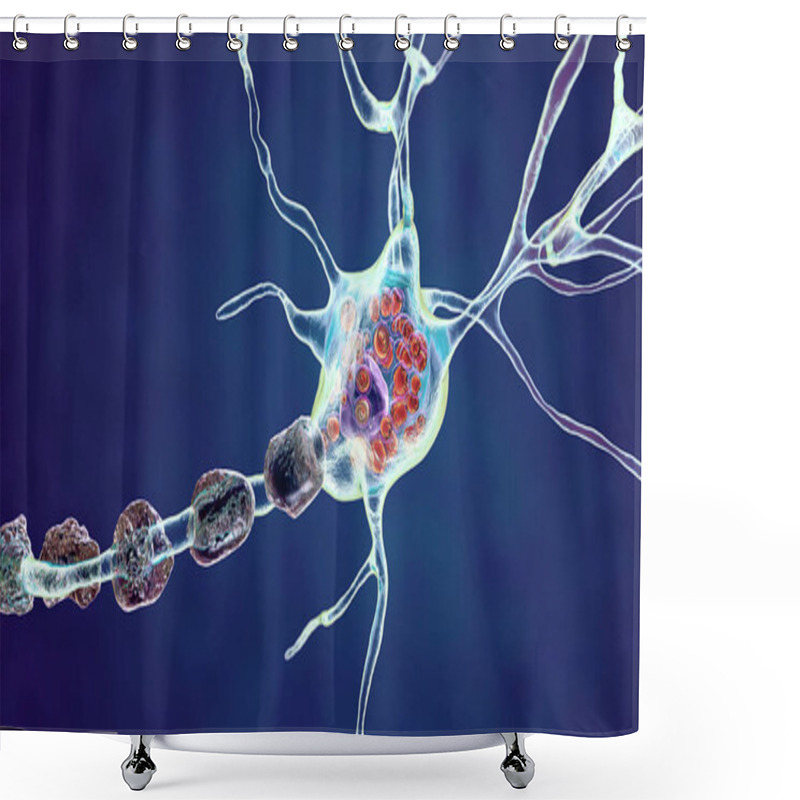 Personality  Brain Neurons In Lysosomal Storage Diseases, Tay-Sachs, Niemann-Pick, Fabry And Other. 3D Illustration Showing Swollen Neurons With Lamellar Inclusions Due To Accumulation Of Gangliosides In Lysosomes Shower Curtains