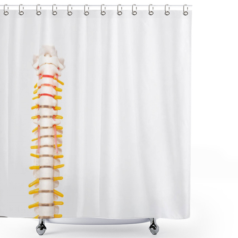 Personality  Cervical And Thoracic Spine On A White Background. Intervertebral Hernia Of The Cervical Spine, Rupture Of The Fibrous Ring. Osteochondrosis Shower Curtains