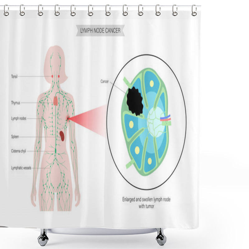 Personality  Lymphoma Cancer Concept Shower Curtains