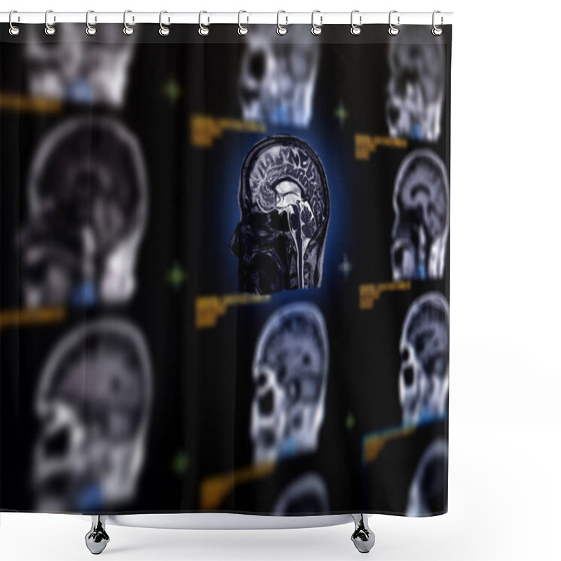 Personality  Selective Focus Of MRI Brain Sagittal Plane For Detect A Variety Of Conditions Of The Brain Such As Cysts, Tumors, Bleeding, Swelling, Developmental And Structural Abnormalities Or Infections . Shower Curtains