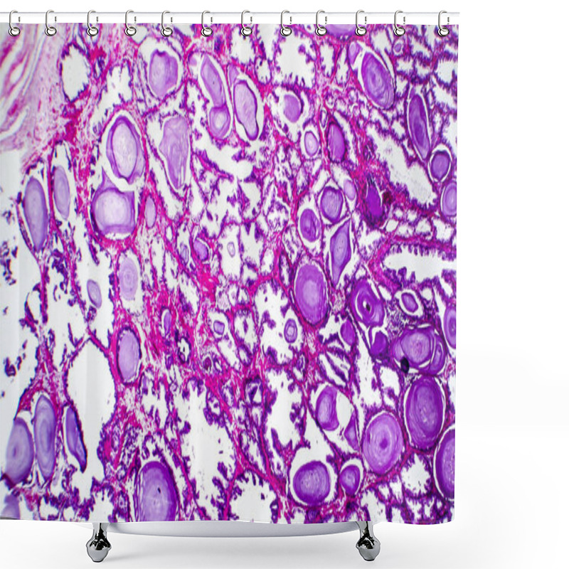 Personality  Histopathology Of Prostate Gland Hyperplasia Shower Curtains