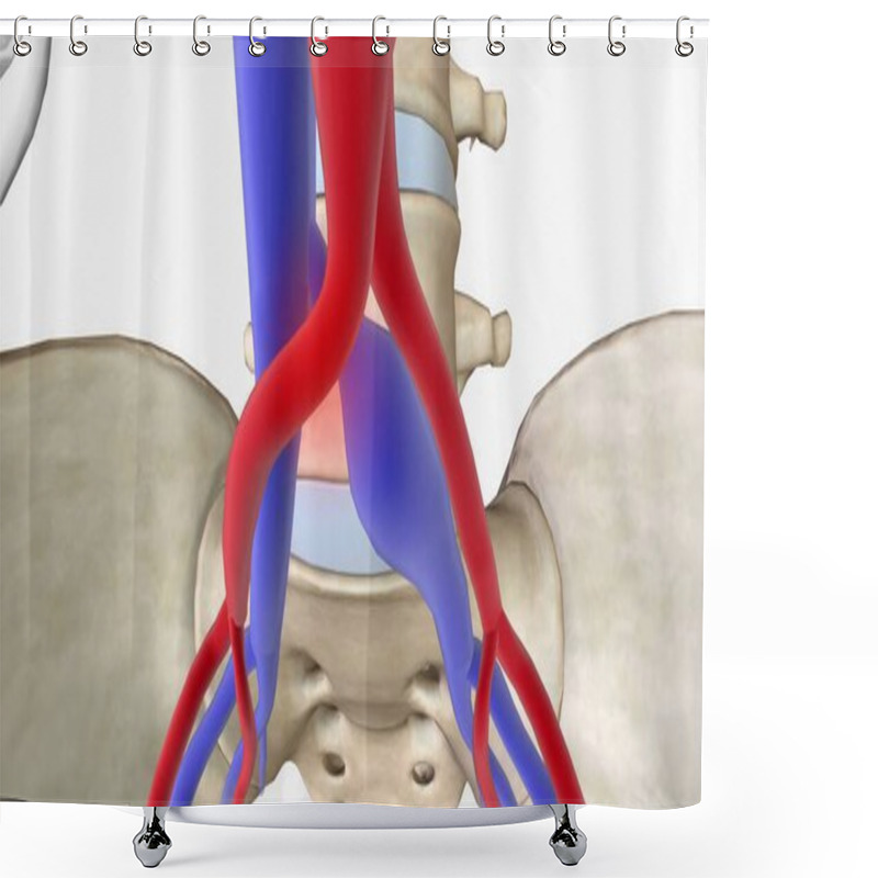 Personality  May Thurner Syndrome Is Compression Of The Left Common Iliac Vein Between The Right Common Iliac Artery And The 5th Lumbar Vertebra Of The Spine. 3D Rendering Shower Curtains