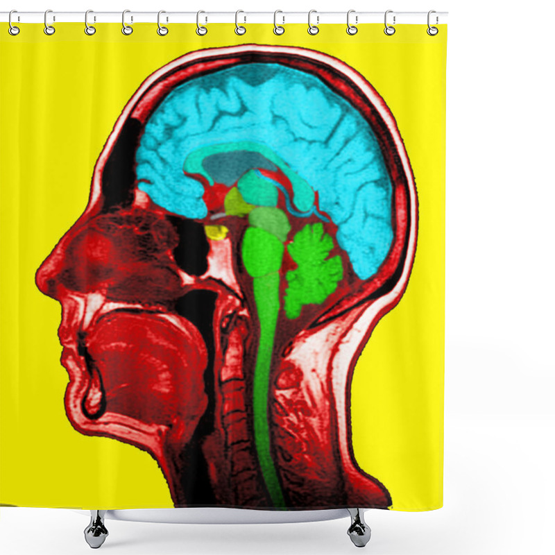 Personality  Sagittal Section Shower Curtains