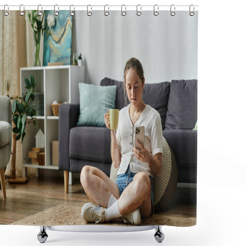 Personality  A Woman With Vitiligo Relaxes With A Cup, Engaged In Her Phone In A Cozy Setting. Shower Curtains