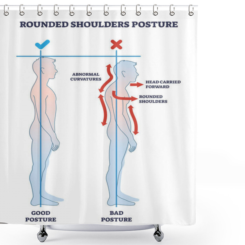 Personality  Rounded Shoulders Posture With Body Alignment Forward Outline Diagram. Labeled Educational Side View Scheme And Good Or Bad Example Comparison Vector Illustration. Abnormal Spine Curvature Deformation Shower Curtains