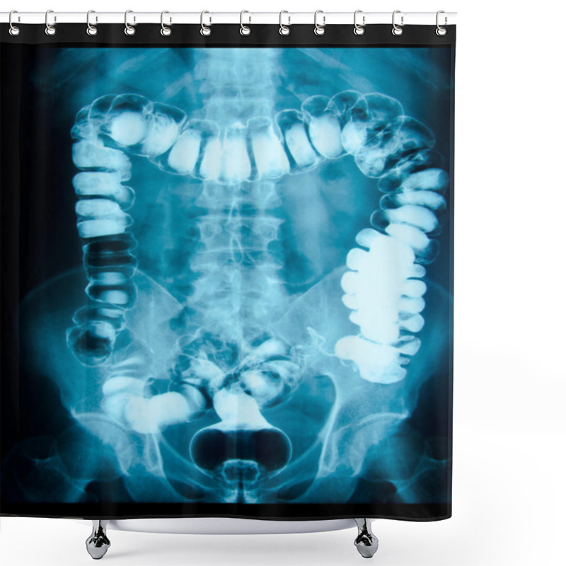 Personality  Intestinal Abdominal Xray Shower Curtains