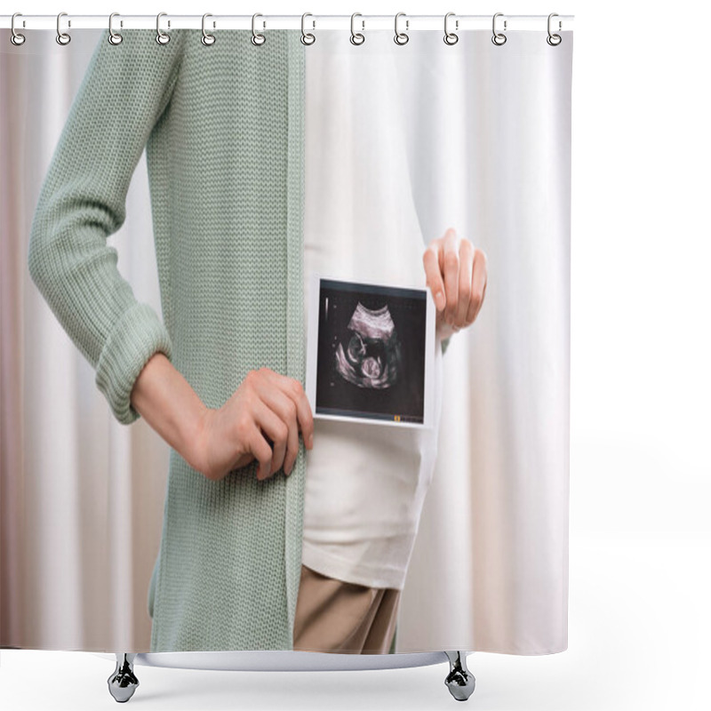 Personality  Pregnant Woman With Ultrasound Scan Of Baby Shower Curtains