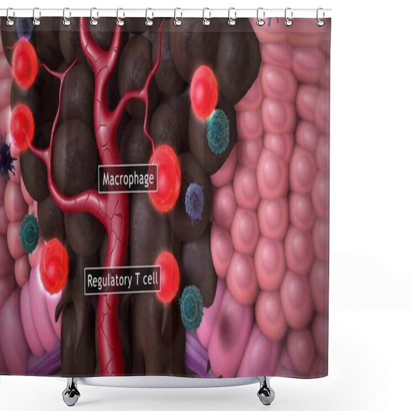 Personality  Melanoma Or Skin Cancer. Layers Of The Human Skin. Shower Curtains