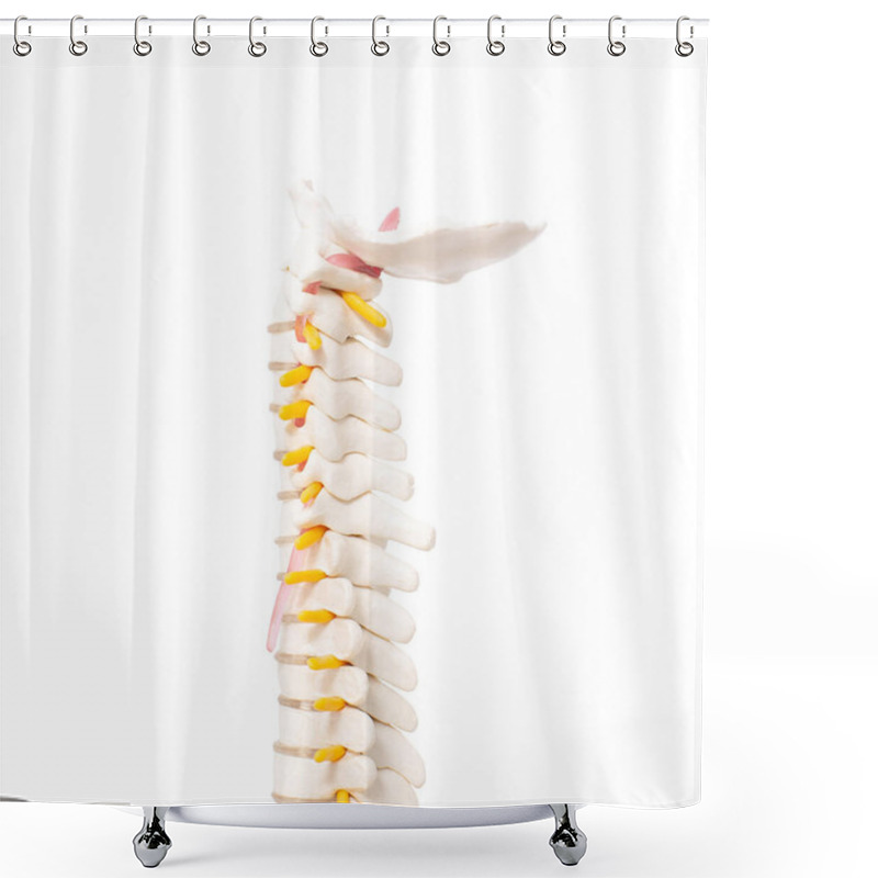 Personality  Cervical And Thoracic Spine On A White Background, Isolate. Osteochondrosis And Degenerative Changes In The Spine, Microspondylia Shower Curtains