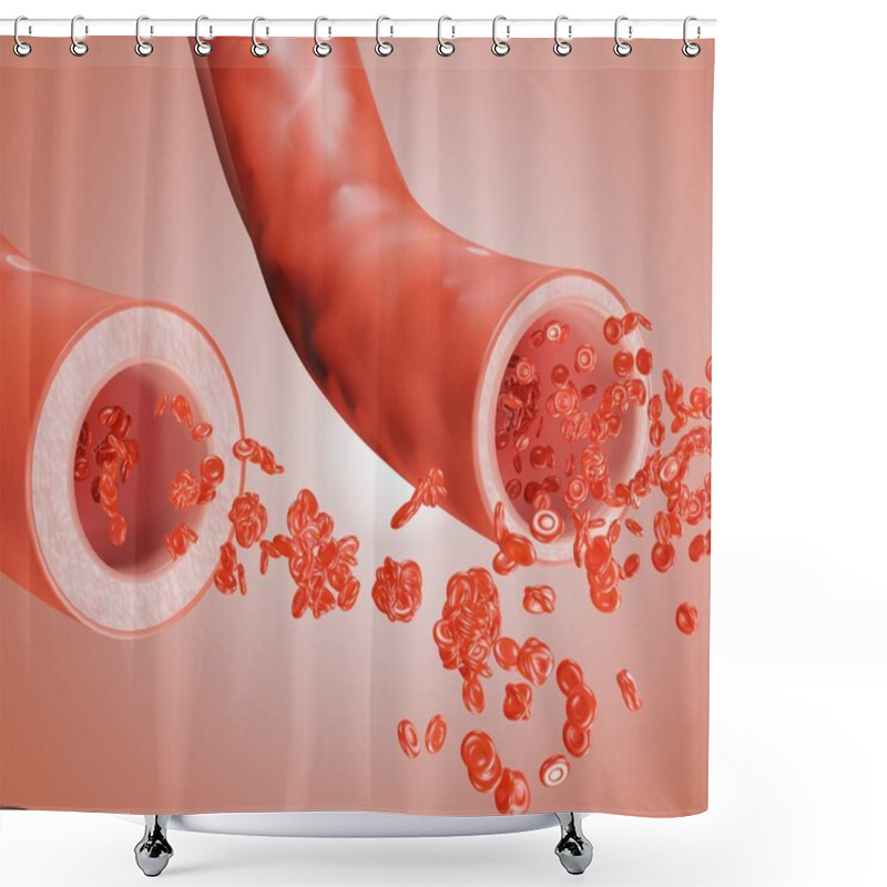 Personality  Normal Blood Vessel And Widening Blood Vessels, Vasodilation, Also Known As Vasorelaxation, Is The Widening Of Blood Vessels 3d Rendering Shower Curtains