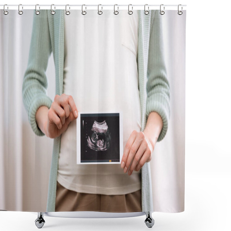 Personality  Pregnant Woman With Ultrasound Scan Of Baby Shower Curtains