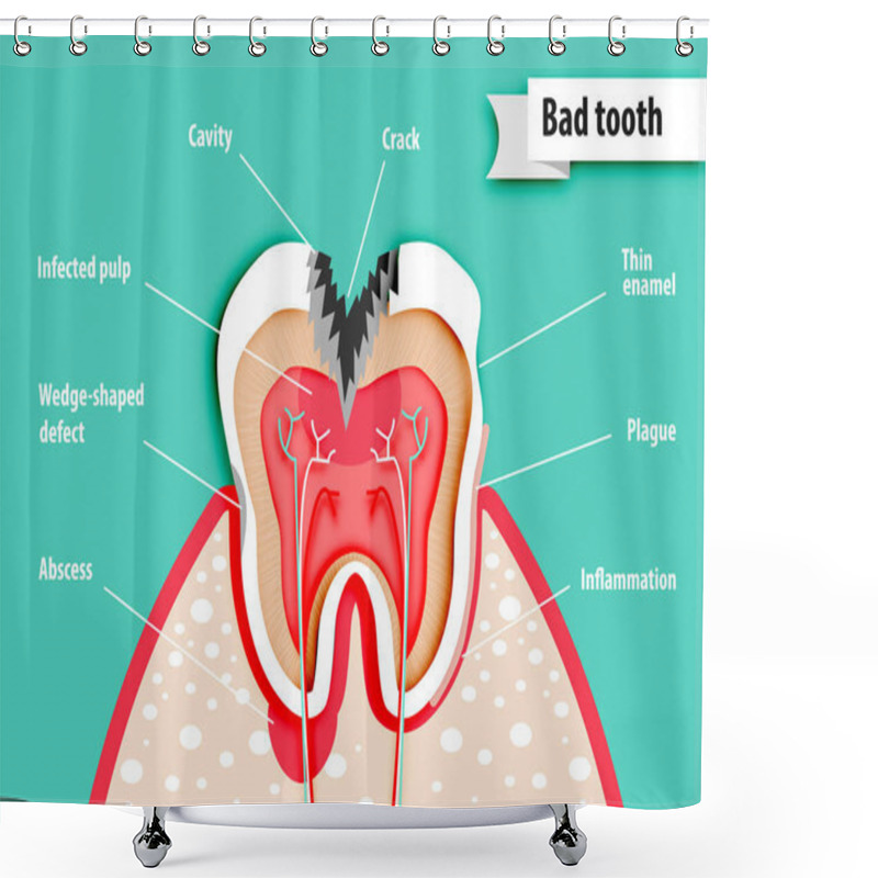 Personality  Paper Art Of Health Science About Bad Tooth  Vector Shower Curtains