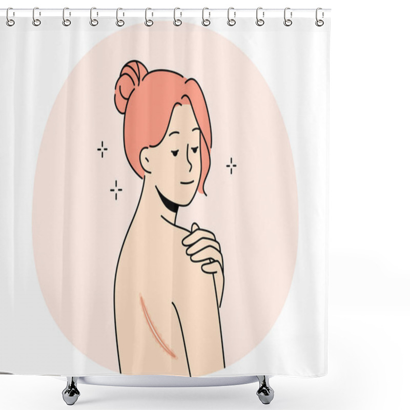 Personality  Naked Woman With Scar On Back. Female Demonstrate Mark Or Wound On Body. Skin Imperfection. Vector Illustration. Shower Curtains