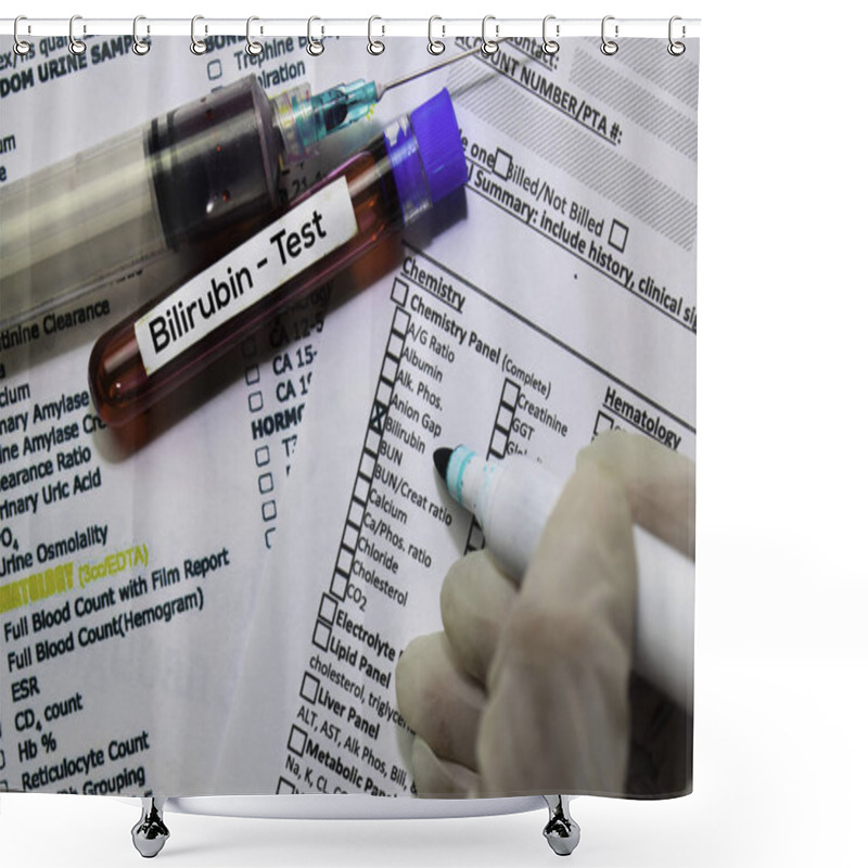 Personality  Bilirubin - Test With Blood Sample. Top View Isolated On Office Desk. Healthcare/Medical Concept Shower Curtains