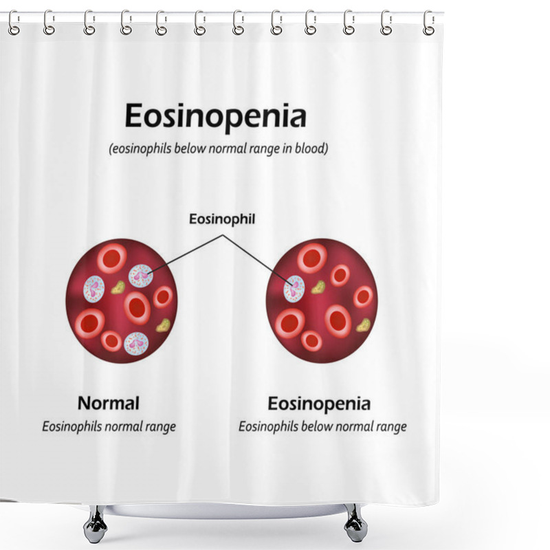 Personality  Eosinophils Below Normal Range  In Blood. Eosinopenia. Infographics. Vector Illustration Shower Curtains