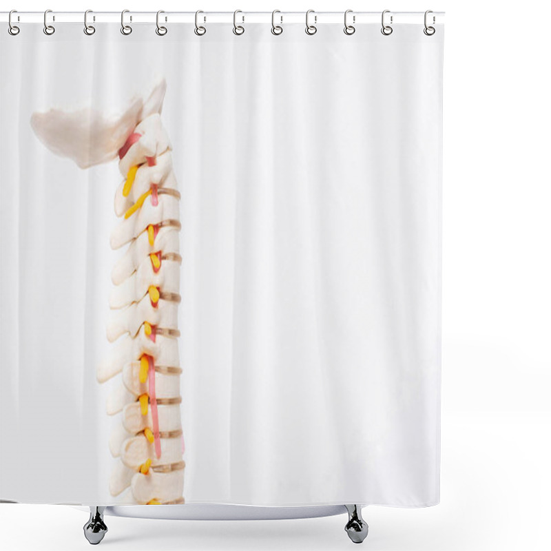 Personality  Model Of The Cervical Spine With Blood Vessels On A White Background. The Concept Of Lordosis And Spondylosis Of The Cervical Spine Shower Curtains