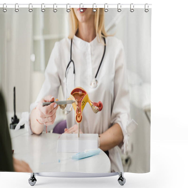 Personality  Gynecologist Explains Uterus Structure On The Example Of Model. Gynecologist Consultation About Complaints, Gynecological History, Previous Or Current Diseases Of Reproductive System Shower Curtains