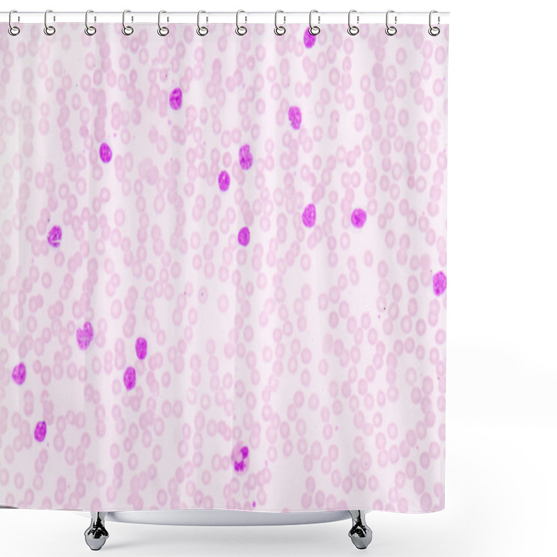 Personality  Blood Cancer Smear Shower Curtains